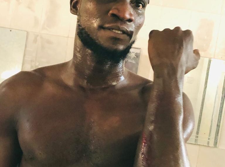 PHOTOS: Karela United players beaten by fans of Berekum Chelsea