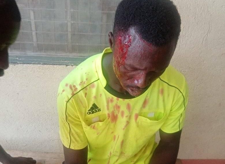 VIDEO: Shameful footballer hit referee  with metal in Berekum
